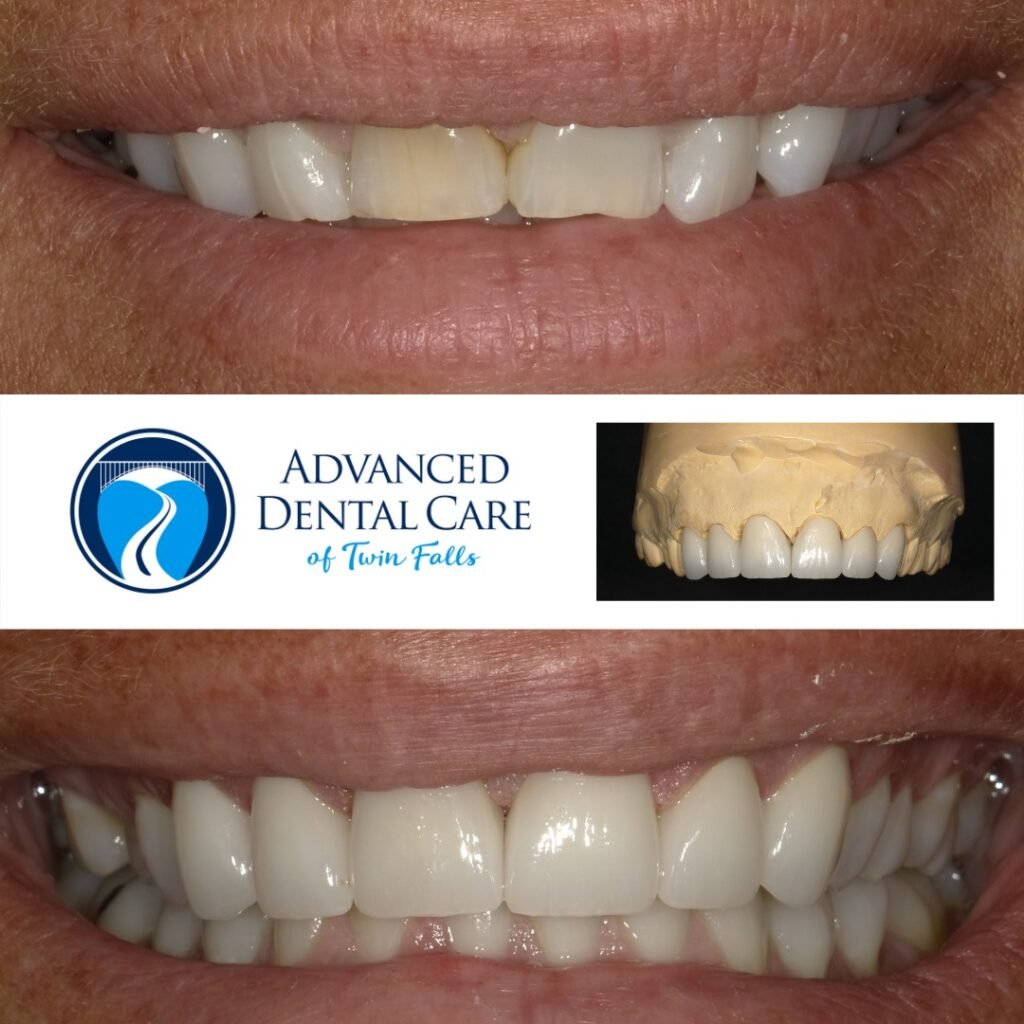 Exploring the Benefits of General Dentistry Services 8 Exploring the Benefits of General Dentistry