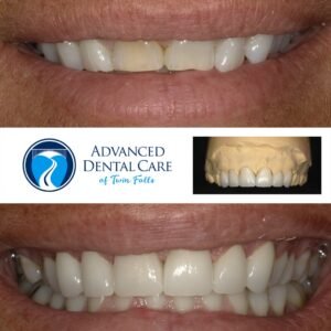 Exploring the Benefits of General Dentistry Services 1 173183042 2932201680385395 5733578128137795783 n