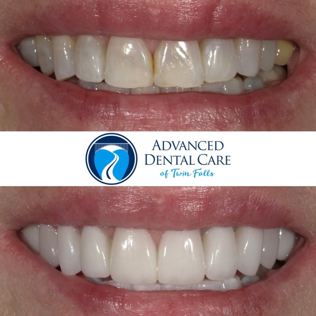 Revitalize Your Confidence - The Transformative Power of Cosmetic Dentistry Services 6 Revitalize Your Confidence