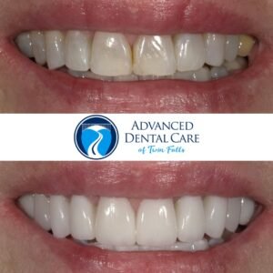 Revitalize Your Confidence - The Transformative Power of Cosmetic Dentistry Services 1 319686077 4960530054050691 5223159745231584697 n