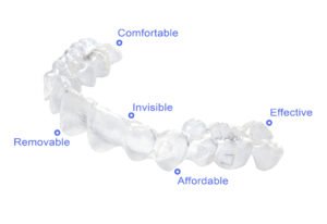 The Ultimate Invisalign FAQ: Everything You Need to Know Before Starting Treatment in Twin Falls, ID 1 AdobeStock 75402155